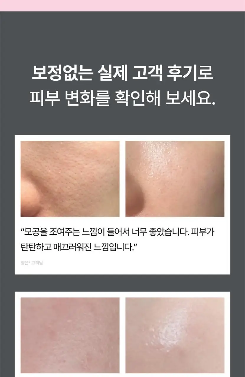 [모공탄력] 셀리맥스 더 비타 A 레티날 샷 타이트닝 부스터 15ml 상세페이지 22